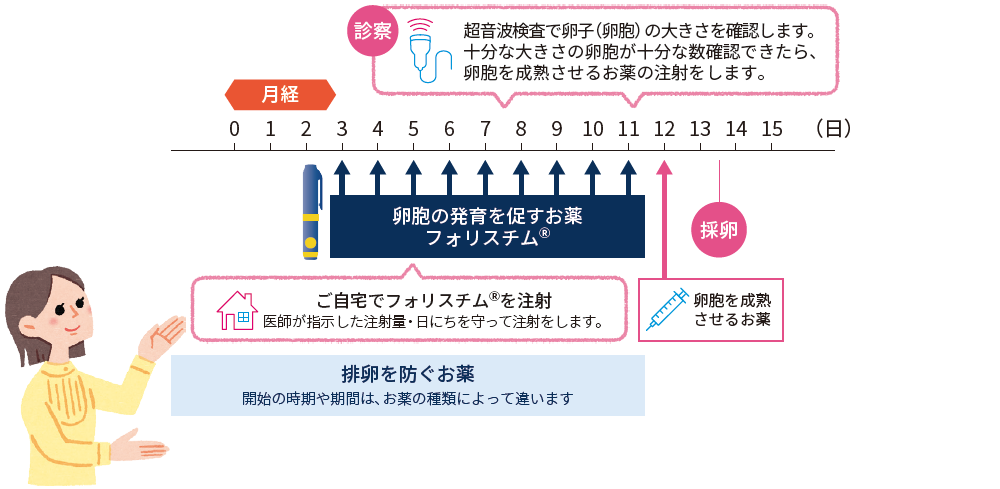 フォリスチム®️とは？（生殖補助医療（ART）） – follistim